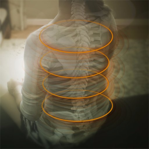 Transforming scoliosis treatment.