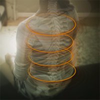 Green Sun Medical (@dynamicbrace) 's Twitter Profile