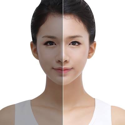 Get the best Cosmetics Plastic surgery in Korea with Synergy Plastic surgery Clinic