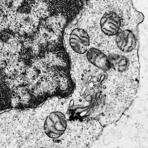 The Hess lab investigates the metabolic basis of lymphocyte function and translational aspects of immunometabolic regulation.