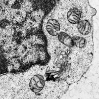 Immunometabolism (@hesslab) 's Twitter Profile