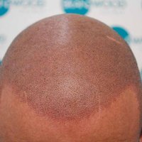 Scalp Doctor (@scalp_doctor) Twitter profile photo