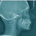 Oral Radiology (@oral_radiology) Twitter profile photo Oral Radiology (@oral_radiology) Twitter profile photo
