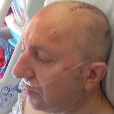 Early onset Parkinson's Disease (mercury induced?). Had Deep Brain Stimulation 2016. Read my DBS blog! https://t.co/7E7gatj6we for DBS/Parkinson's videos!