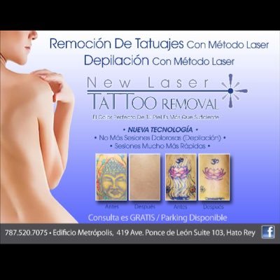 REMOCION DE TATUAJES Y DEPILACIÓN por método LASER La forma mas rápida y segura de remover tatuajes ya no deseados. Utilizando la más alta tecnología LASER.