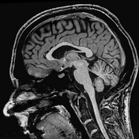 neurostefan (@stfnrpplngr) 's Twitter Profile