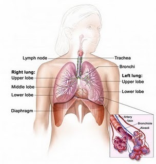 How to cure mesothelioma and lung cancer. How to prevent it