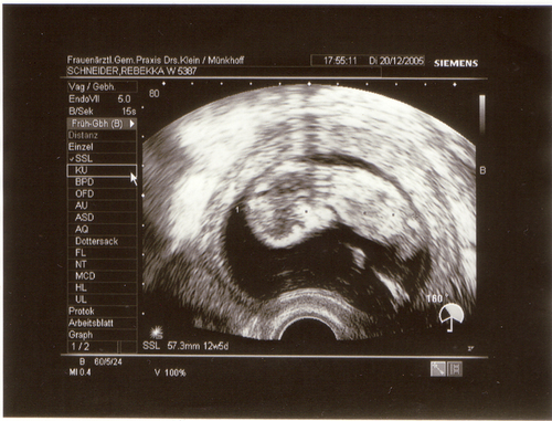 Lee Profile