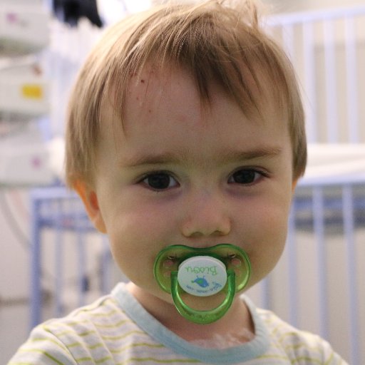 flo a un peu plus de deux ans et souffre du syndrome de Wiskott Aldrich sans don de moelle osseuse il a peu de chance de survivre.