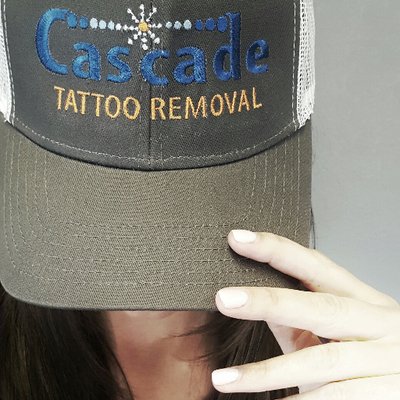 Image Gallery  Cascade Medical Spa  Tattoo Removal Center