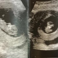 Wildenberg Freire (@aguiarfreire1) 's Twitter Profile