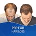 Hair Regrowth by PRP (@hair_prp) Twitter profile photo Hair Regrowth by PRP (@hair_prp) Twitter profile photo