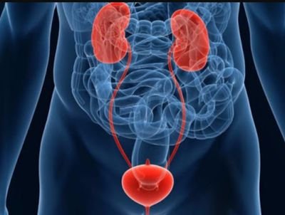 We provide free consultation on Urology diseases kidney stones urogenital cancer Sexual dysfunction and Urologenital Cancer. Its opinion not medication