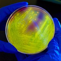 C. difficile Papers (@cdiff_papers) 's Twitter Profile
