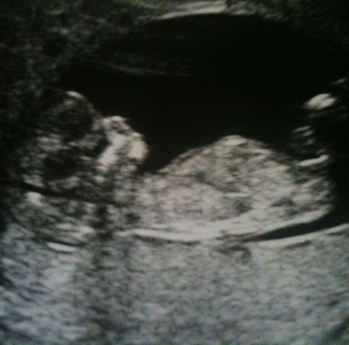 OliverBain's profile picture. The youngest Bain ever!