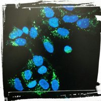 Wallace HPV Lab (@wallacehpvlab) 's Twitter Profile
