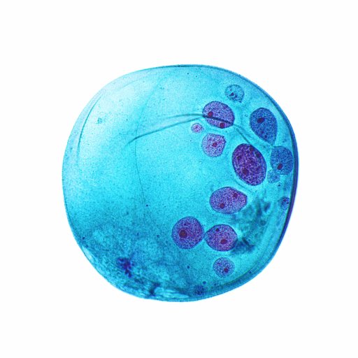 Breast Pathology Profile