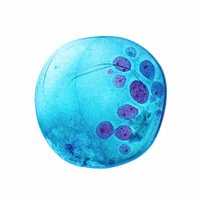 Breast Pathology (@breastpathology) 's Twitter Profile
