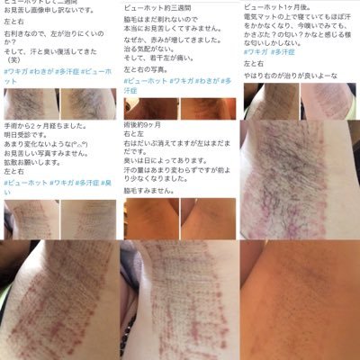 ワキガール ビューホット受けました Wak1gail Twitter