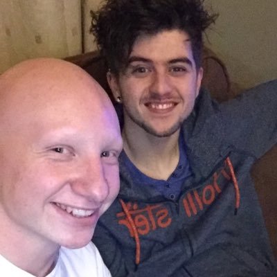 22 Year Old Irish Lad who suffers with Alopecia and I Want to Raise More Awareness about It through using social media and fundraising in my local area!