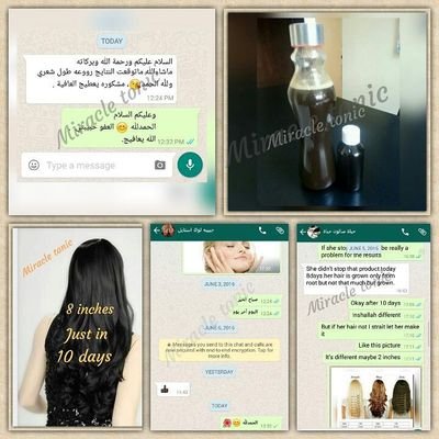 miracle__tonic2's profile picture. إليك الحل منتج miracle لتطويل الشعر 8 انش في 10 ايام المنتج طبيعي

 نضمن لك المتيجة بصمانك لنا الالتزام بتعليمات المنتج ❤ لتواصل ع واتس 00971555391013