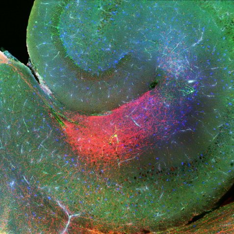 Exeter Neuroscience Profile