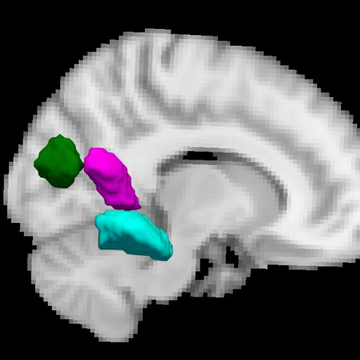 Cognitive Neuroscience Lab @Penn. We study scene perception, navigation, spatial cognition, and memory.