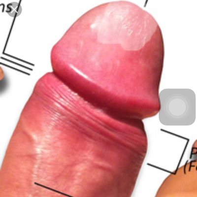 New Penis Implant Created To Alert Your Cell Phone When Your Man Is Cheating