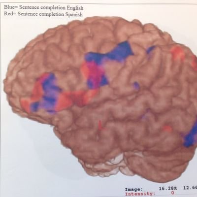 🇵🇪 🇨🇦 Epileptologist/Chief, Division of Neurology/Co-Director, Epilepsy Program, Western University @westernuepilep/
Jack Cowin Epilepsy Research Chair