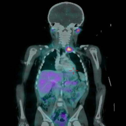 NBAlliance's profile picture. Neuroblastoma is a brutal cancer that attacks children.  Once it comes back it is incurable.  Help us change that.