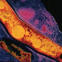 WorldTBDay (@worldtbday) 's Twitter Profile