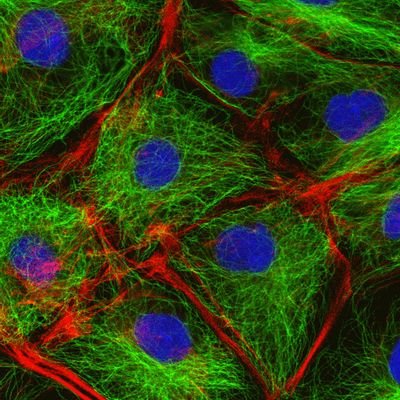 Organelle Candidate for 2016
The Superior of Structure!
#VoteCytoskeleton