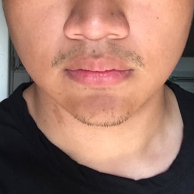 aideeaL's profile picture. my knee. is messed up.