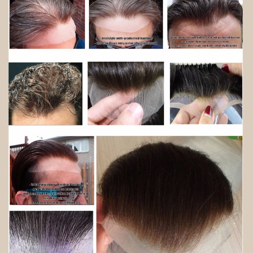 We, Shunfa hair factory is the professional hair factory in China.  we deal with hair replacement , toupees, l wigs, extensions , hair closure for many years.