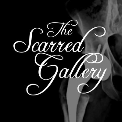 Cancer survivors thriving! Stay tuned for our next event January 2017 #TheScarredGallery