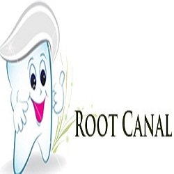 Root canal treatment is needed when the blood or nerve supply of the tooth (known as the pulp) is infected through decay or injury.