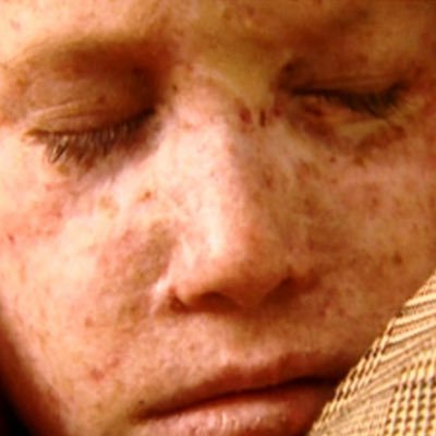 Enfantdelunelgf's profile picture. Bonjour ! Ce compte porte sur la maladie rare des enfants de la lune pour un projet d'abord humanitaire puis scolaire, suivez-nous pour plus d'informations 🚨