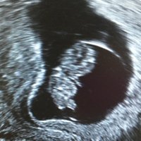 Becoming Dad (@dad_becoming) 's Twitter Profile