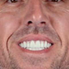 jonlackeysteeth's profile picture. Cubs fan. John Lackey's Teeth Fan. The End.