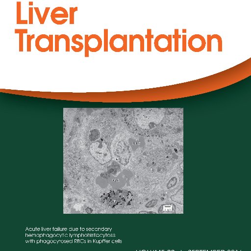 Official journal of AASLD-delivering high-quality research in liver transplantation | Editor @drbobbybrown |#SoMe Ed @LizzieAbyMD @rrosenblattmd |RT≠endorsement