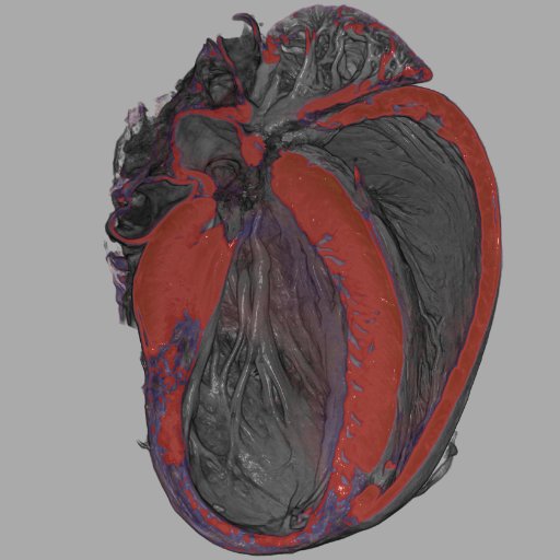 ggrayMIlab's profile picture. Emeritus Professor of Cardiovascular PharmacologyOpinions my own.