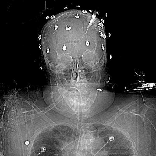 Brain Salvage Specialist: Neurointensivist, Neurosurgical Hospitalist, Neurophysiologist, Neurosonologist, Neuroimager, Thrombologist and Ethicist.