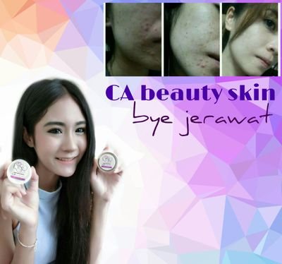 mengatasi masalah kulit mu,tanpa bikin ketergantungan || BESTSELLER || CONSULTASI || PIN 589F01E4 || WA 087885901373 || @cream_dr_kamal || ig : clinicperawatan