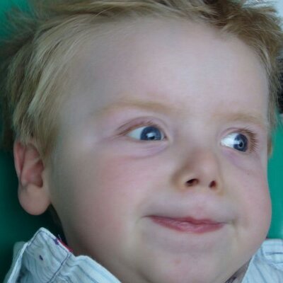 Menkes Disease On Twitter Passed A Kidney Stone Alongside My