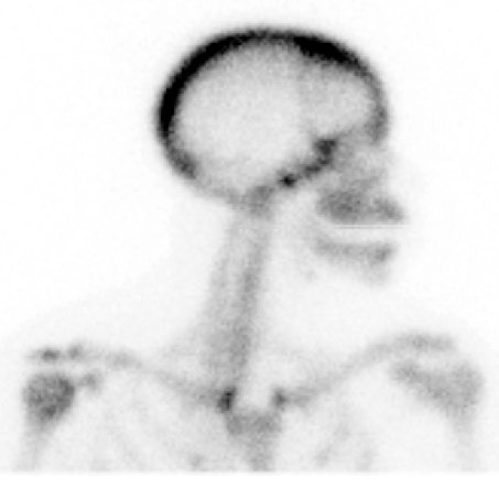 NucsRadiology's profile picture. An educational website for Nuclear Medicine and Radiology. Matthew Kruse, M.D.