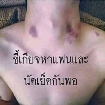 รักที่หายาก