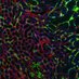 Tissue Repair PhD (@repairphd) Twitter profile photo Tissue Repair PhD (@repairphd) Twitter profile photo