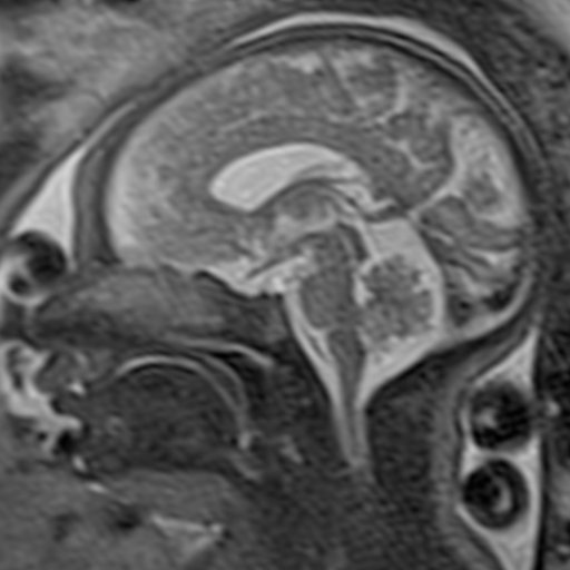 Fetal MRI education