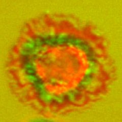 Rheumatology translational research @UCL focusing on lipid metabolism defects in autoimmunity #lupus #arthritis #Sjogrens #dermatomyositis #MS