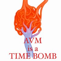 AVM&Brain Aneurysm (@avm_malaysia) 's Twitter Profile